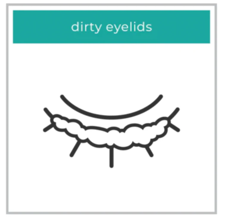 WE LOVE EYES Eyelid Margin Cleansing Brush - Image 5