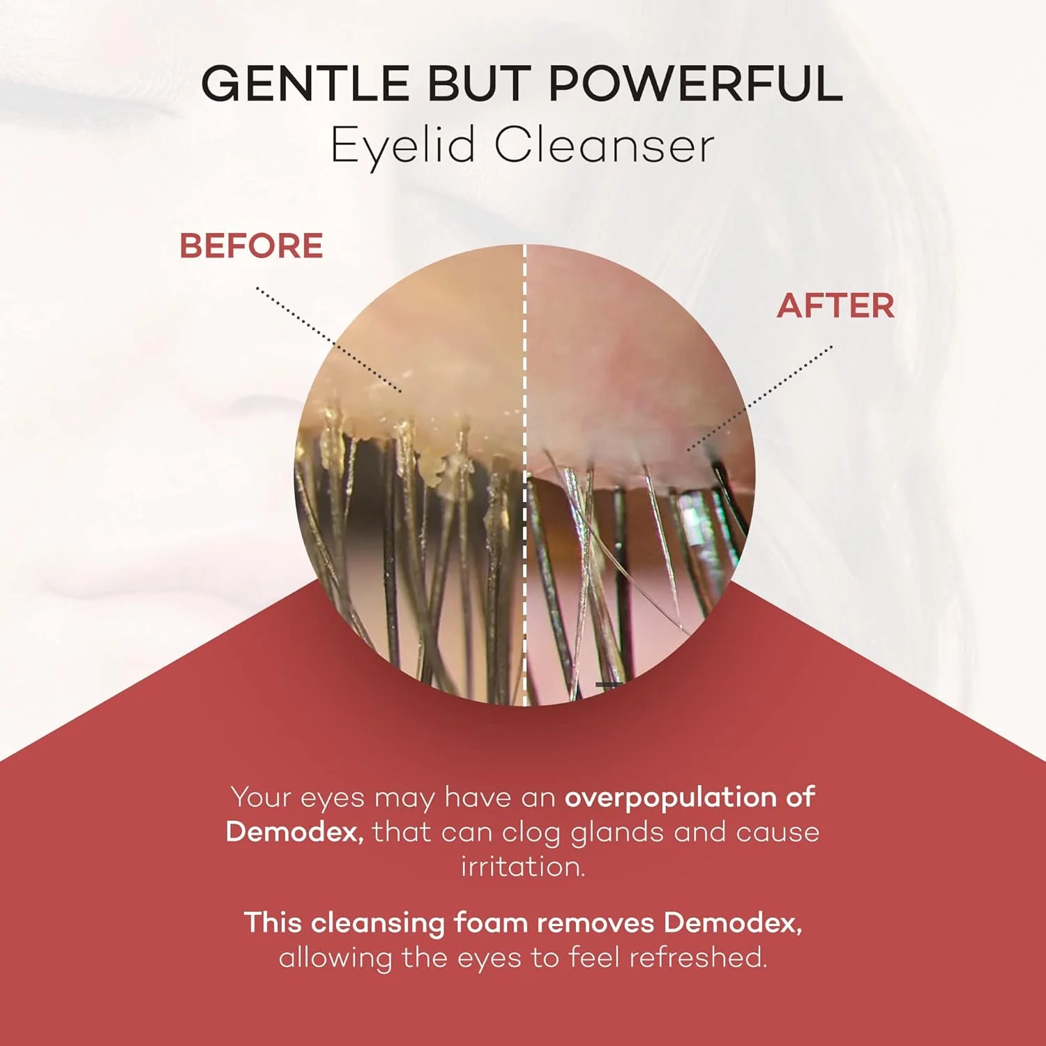 ZocuFoam™ Eyelid Cleanser - Image 4